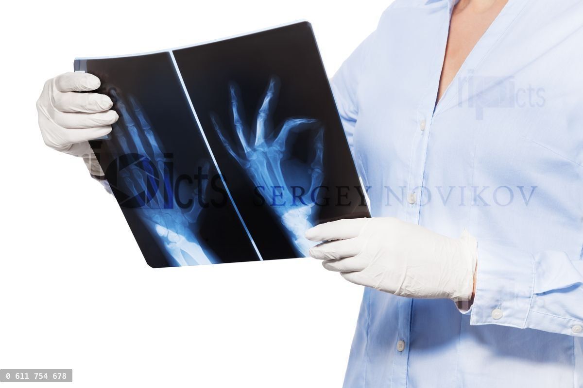 Close shoot hand and fingers xray in doctor hands