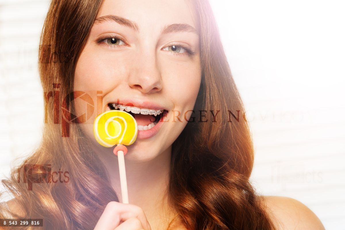Woman with dental braces biting off swirl lollipop
