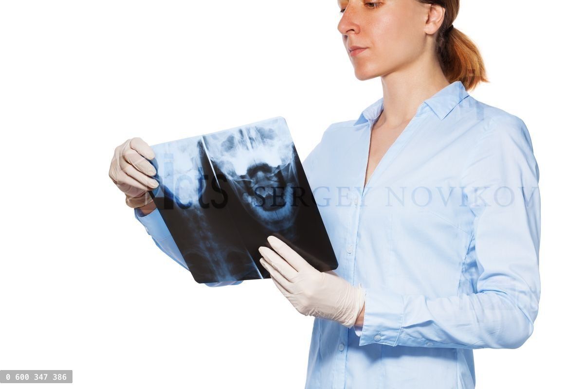 Woman doctor hold patient xray with head and teeth