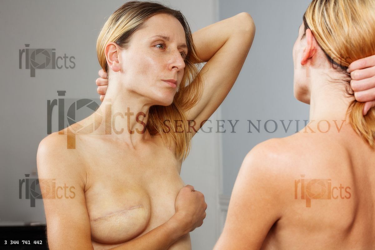 Woman observe plastic surgery results after mastectomy in mirror